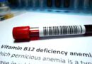 Vitamin B12 deficiency: Signs of this deficiency to spot on your body
