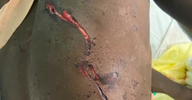 Hwange Man Survives Night of Terror After Lion Cubs Attack