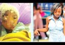 Defying social stigma: Girl beats Stage 4 cancer Defying social stigma: Girl beats Stage 4 cancer
